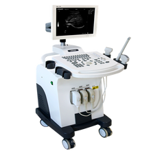DW370 Full digital medical diagnostic ultrasound equipment